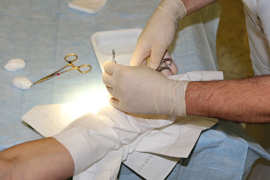 chirurgický zákrok u figuranta v malém zákrokovém sálku; foto: šumpersko.net
