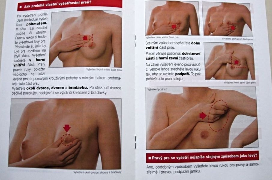 samovyšetření prsu zdroj: archiv
