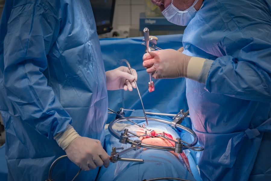 Unikátní meziobratlový implantát, který vyvinuli neurochirurgové olomoucké fakultní nemocnice, už úspěšně pomáhá pacientům zdroj foto: FN OL