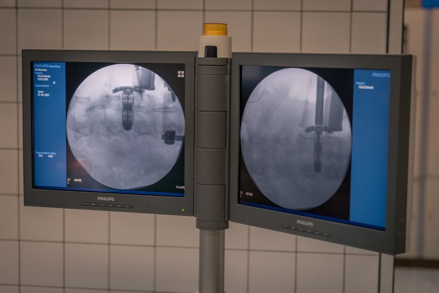 Unikátní meziobratlový implantát, který vyvinuli neurochirurgové olomoucké fakultní nemocnice, už úspěšně pomáhá pacientům zdroj foto: FN OL